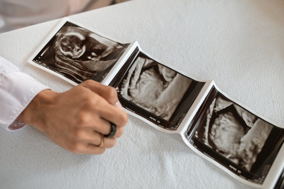 Eisprung: Wann bekommen Frauen ihren Eisprung?